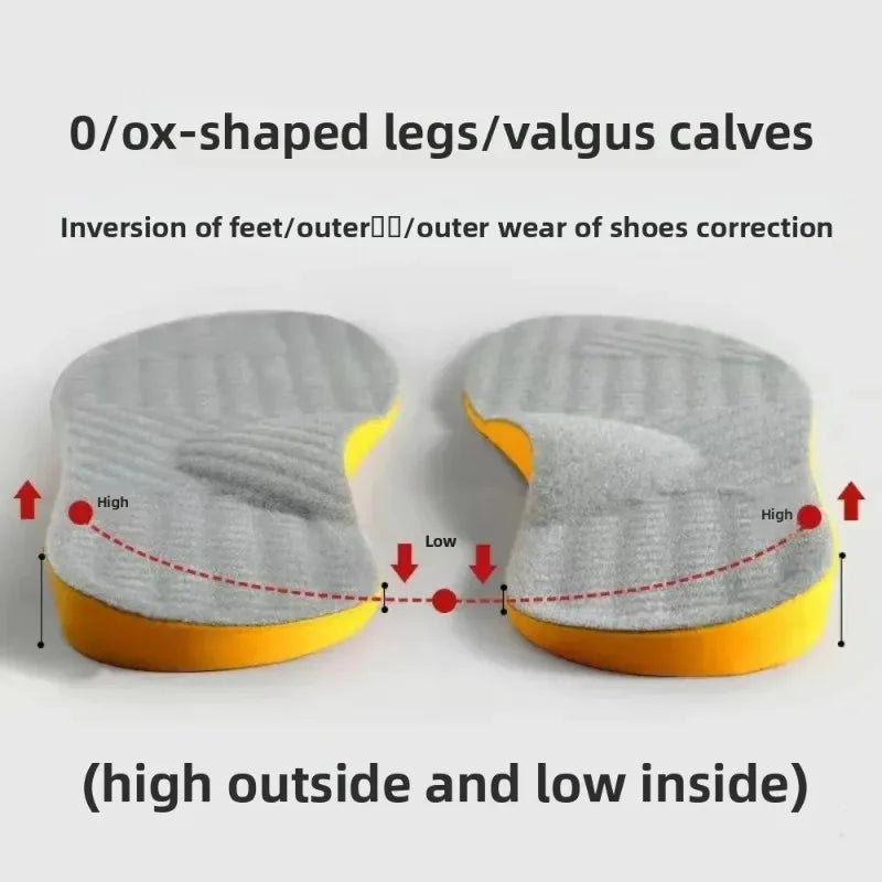 Orthotic Insoles for Men Women Leg Posture Correction Shoe Pad for Overpronation Supination Bow Legs Flat Feet Arch Support