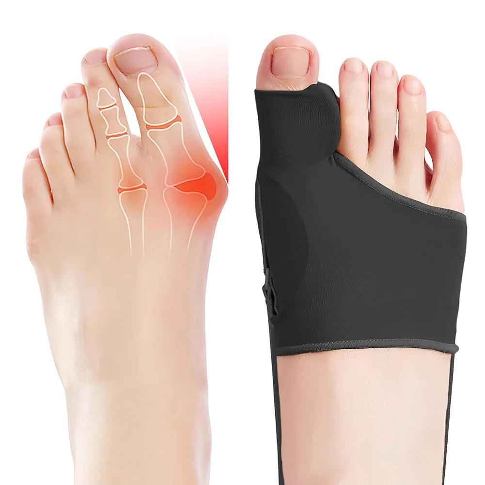 Bunion Relief Toe Corrector Orthopedic Bunion Corrector Splint For Enhanced Foot Alignment Breathable Lightweight Orthotics