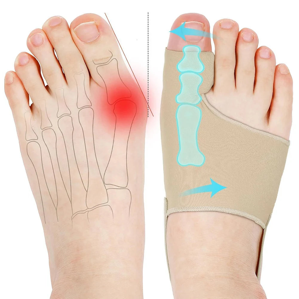 Bunion Relief Toe Corrector Orthopedic Bunion Corrector Splint For Enhanced Foot Alignment Breathable Lightweight Orthotics