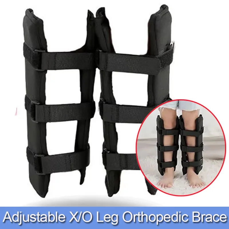 Adjustable O/X Leg Type Correction Belt Pediatric Kids Leg Posture Corrector Brace For Children Knees Valgus Straighten