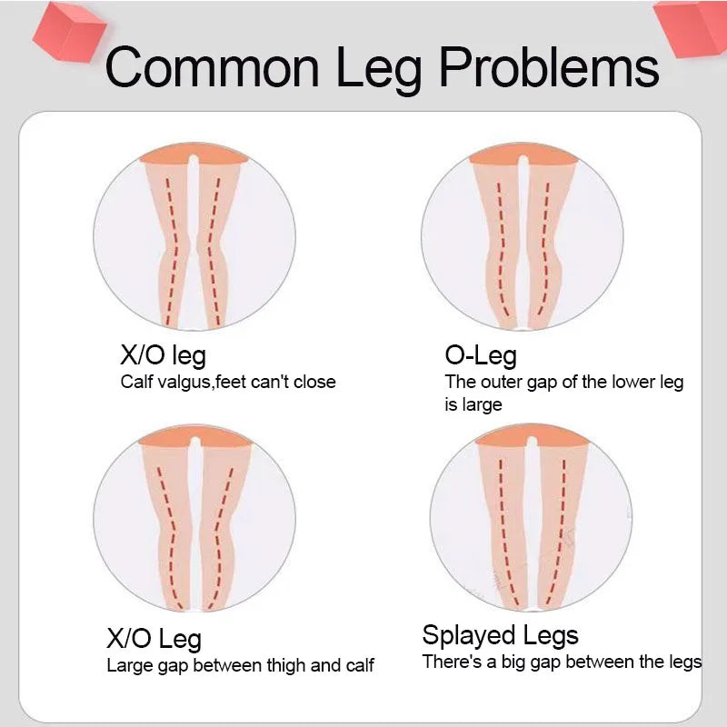 Adjustable O/X Leg Type Correction Belt Pediatric Kids Leg Posture Corrector Brace For Children Knees Valgus Straighten